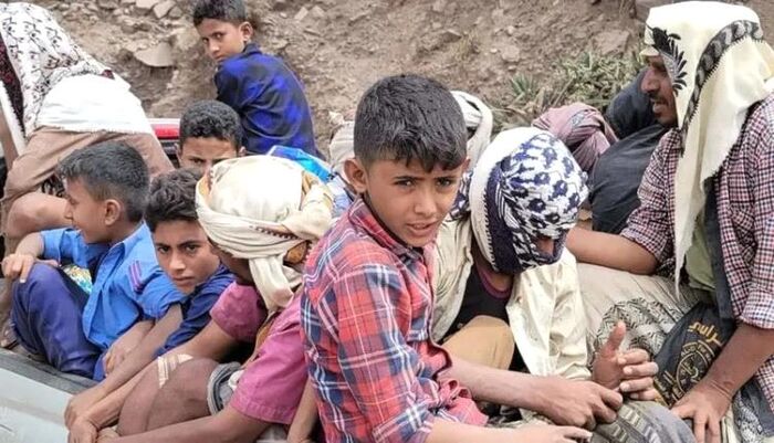 في ريمة | جريمة حوثية صامتة: 7 من كل 10 أطفال بالمحافظة يعانون التقزم ويتقلصون جوعاً