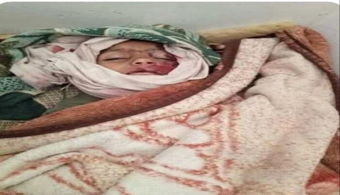 مشهد مأساوي يختصر حجم الكارثة | عطش قاتل في صبر تعز.. طفل يفارق الحياة خلال مطاردة "شربة ماء"