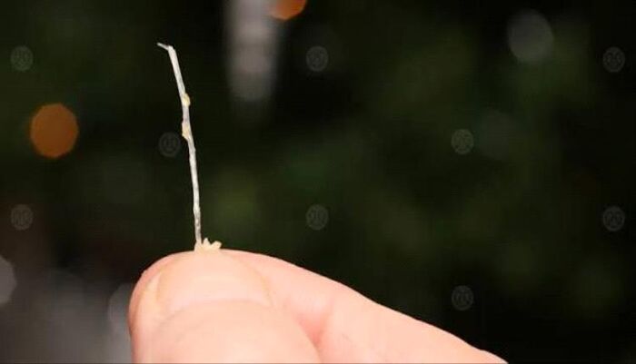 تفاصيل ماساوية | شوكة سمكة في تعز.. التردد القاتل يحرم فتاة من الأوكسجين ويصيبها بالتشنجات