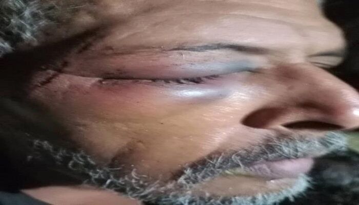 شاهد | صور اعتداء وحشي.. مرافق مسؤول إخواني وشقيقه ينهالان بالضرب المبرح على ستيني في تعز