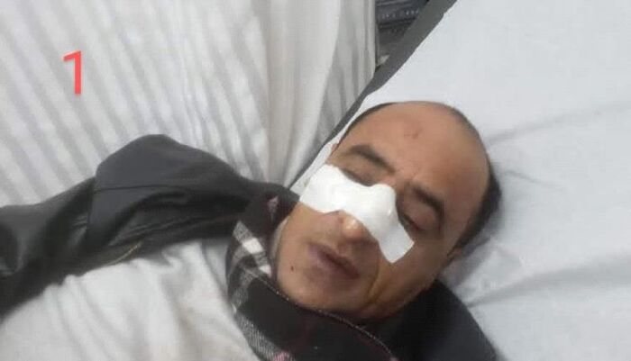 في تعز .. مسلحون يختطفون مستشار المحافظ بطريقة مهينة بعد الاعتداء عليه داخل مجلس مقيل